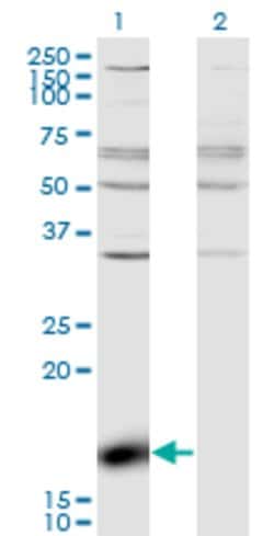 ZBP1, Mouse anti-Human, Clone: 2C10, Abnova 100&mu;g; Unconjugated:Antibodies,