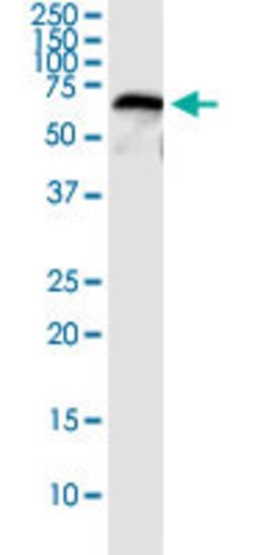 CFHR5, Rabbit anti-Human, Polyclonal Antibody, Abnova 100&mu;L; Unconjugated:Antibodies,