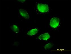 TXNDC5, Mouse anti-Human, Polyclonal Antibody, Abnova 50&mu;g; Unconjugated:Antibodies,