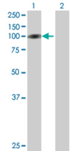 C1orf25, Mouse anti-Human, Polyclonal Antibody, Abnova 50 &mu;g | Buy Online | Abnova | Fisher Scientific
