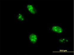 C1orf25, Mouse anti-Human, Polyclonal Antibody, Abnova 50 &mu;g | Buy Online | Abnova | Fisher Scientific