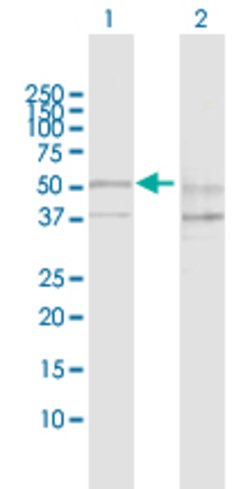 SESN2, Rabbit anti-Human, Polyclonal Antibody, Abnova 100&mu;g; Unconjugated:Antibodies,
