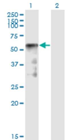 SESN2, Mouse anti-Human, Clone: 1A12, Abnova 100&mu;g; Unconjugated:Anticuerpos