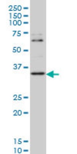 ZIC4, Mouse anti-Human, Clone: 2C2, Abnova 100&mu;g; Unconjugated:Antibodies,