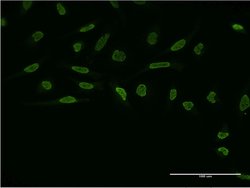ZIC4, Mouse anti-Human, Clone: 3H6, Abnova 100&mu;g; Unconjugated:Antibodies,