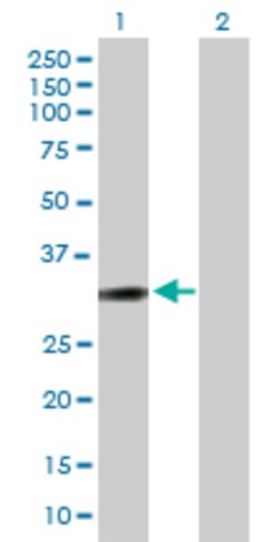 PPP1R1B, Mouse anti-Human, Polyclonal Antibody, Abnova 50&mu;g; Unconjugated:Antibodies,
