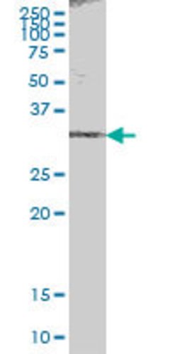 ACBD6, Mouse anti-Human, Polyclonal Antibody, Abnova 50&mu;g; Unconjugated:Antibodies,