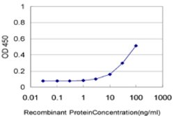 NTNG2, Mouse anti-Human, Clone: 4F11, Abnova 100&mu;g; Unconjugated:Antibodies,