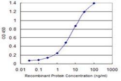TRIM55, Mouse anti-Human, Clone: 1A1, Abnova 100&mu;g; Unconjugated:Antibodies,