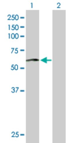 ACCS, Mouse anti-Human, Polyclonal Antibody, Abnova 50&mu;g; Unconjugated:Antibodies,
