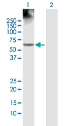 ACCS, Rabbit anti-Human, Polyclonal Antibody, Abnova 100 &mu;L | Buy Online | Abnova | Fisher Scientific