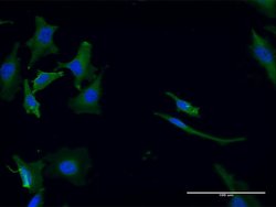 GPT2, Mouse anti-Human, Clone: 7A11, Abnova 100&mu;g; Unconjugated:Antibodies,