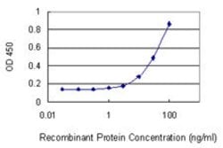 GPT2, Mouse anti-Human, Clone: 7A11, Abnova 100&mu;g; Unconjugated:Antibodies,