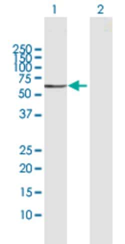 CNDP1, Rabbit anti-Human, Polyclonal Antibody, Abnova 100&mu;L; Unconjugated:Antibodies,