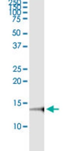NFATC2IP, Rabbit anti-Human, Polyclonal Antibody, Abnova 100&mu;L; Unconjugated:Antibodies,