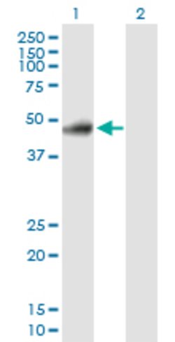 RELT, Rabbit anti-Human, Polyclonal Antibody, Abnova 100 &mu;g | Buy Online | Abnova | Fisher Scientific