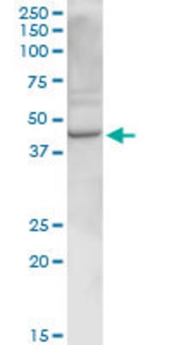 RELT, Rabbit anti-Human, Polyclonal Antibody, Abnova 100 &mu;g | Buy Online | Abnova | Fisher Scientific