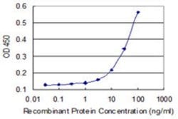 RHPN2, Mouse anti-Human, Clone: 1C5, Abnova 100&mu;g; Unconjugated:Anticuerpos