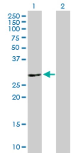 ATP6V1E2, Mouse anti-Human, Polyclonal Antibody, Abnova 50&mu;g; Unconjugated:Antibodies,