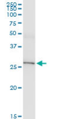 IL33, Mouse anti-Human, Clone: 2D8, Abnova 100&mu;g; Unconjugated:Anticuerpos
