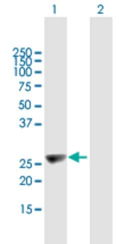 KIFC2, Mouse anti-Human, Polyclonal Antibody, Abnova 50&mu;g; Unconjugated:Antibodies,