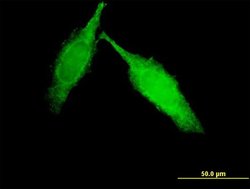IGFN1, Mouse anti-Human, Clone: 5B12, Abnova 100 &mu;g | Buy Online | Abnova | Fisher Scientific