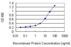 SLC39A13, Mouse anti-Human, Clone: 2G2, Abnova 100 &mu;g | Buy Online | Abnova | Fisher Scientific