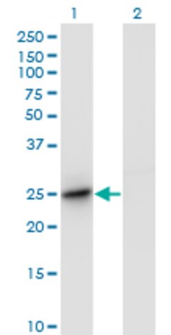 UBTD2, Mouse anti-Human, Clone: 1B8-1B1, Abnova 100&mu;g; Unconjugated:Antibodies,