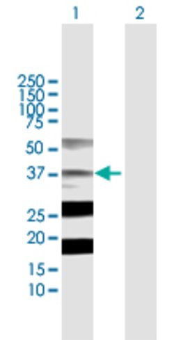 STRADA, Rabbit anti-Human, Polyclonal Antibody, Abnova 100&mu;L; Unconjugated:Antibodies,