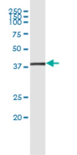 STRADA, Rabbit anti-Human, Polyclonal Antibody, Abnova 100&mu;L; Unconjugated:Antibodies,