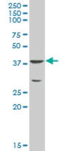 HICE1, Mouse anti-Human, Polyclonal Antibody, Abnova 50&mu;g; Unconjugated:Antibodies,
