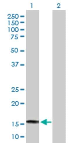 SAT2, Mouse anti-Human, Polyclonal Antibody, Abnova 50&mu;g; Unconjugated:Antibodies,