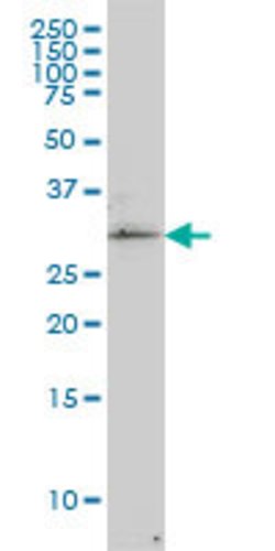 TP53RK, Mouse anti-Human, Clone: 2A9, Abnova 100&mu;g; Unconjugated:Antibodies,