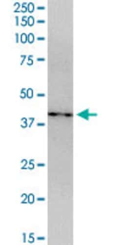 CDCA5, Mouse anti-Human, Polyclonal Antibody, Abnova 50&mu;g; Unconjugated:Antibodies,