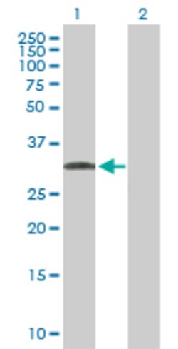 C1QTNF7, Mouse anti-Human, Polyclonal Antibody, Abnova 50&mu;g; Unconjugated:Antibodies,
