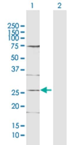 DDIT4L, Rabbit anti-Human, Polyclonal Antibody, Abnova 100&mu;L; Unconjugated:Antibodies,