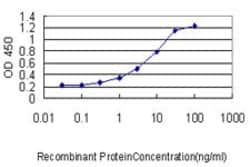CMTM5, Mouse anti-Human, Clone: 2G1-6B10, Abnova 100&mu;g; Unconjugated:Antibodies,