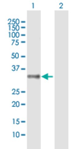 MRGPRX2, Mouse anti-Human, Polyclonal Antibody, Abnova 50&mu;g; Unconjugated:Anticuerpos