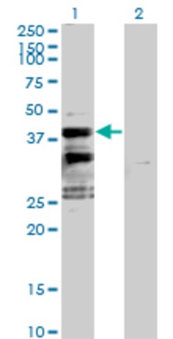SFXN2, Mouse anti-Human, Polyclonal Antibody, Abnova 50&mu;g; Unconjugated:Antibodies,