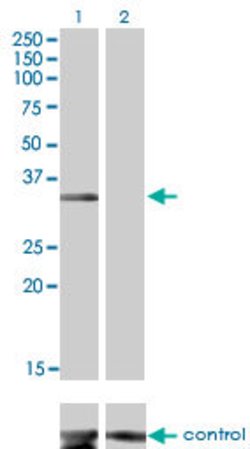 MSI2, Mouse anti-Human, Clone: 2D12, Abnova 100&mu;g; Unconjugated:Antibodies,