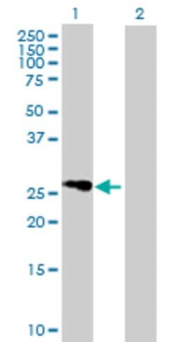 FLJ25006, Mouse anti-Human, Polyclonal Antibody, Abnova 50&mu;g; Unconjugated:Antibodies,