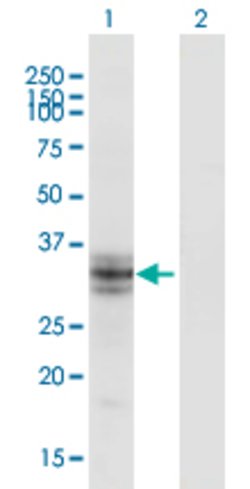 B3GALT6, Mouse anti-Human, Clone: 3E5, Abnova 100&mu;g; Unconjugated:Antibodies,
