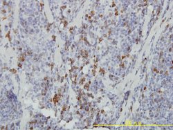 ASB9, Mouse anti-Human, Clone: 1D8, Abnova 100 &mu;g | Buy Online | Abnova | Fisher Scientific