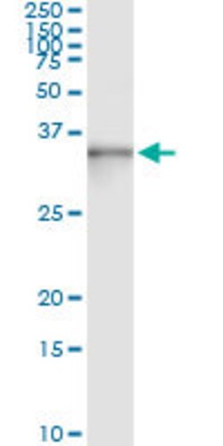 ASB9, Mouse anti-Human, Clone: 1D8, Abnova 100 &mu;g | Buy Online | Abnova | Fisher Scientific