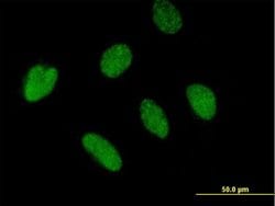 ZBTB46, Mouse anti-Human, Polyclonal Antibody, Abnova 50&mu;g; Unconjugated:Antibodies,