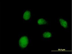 NANP, Mouse anti-Human, Polyclonal Antibody, Abnova 50&mu;g; Unconjugated:Anticuerpos