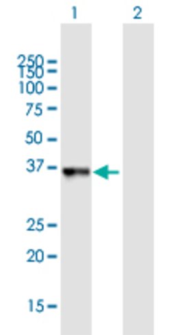 C10orf46, Mouse anti-Human, Polyclonal Antibody, Abnova 50&mu;L; Unconjugated:Antibodies,