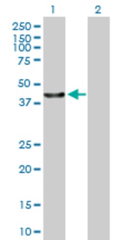 C13orf31, Mouse anti-Human, Polyclonal Antibody, Abnova 50&mu;g; Unconjugated:Antibodies,