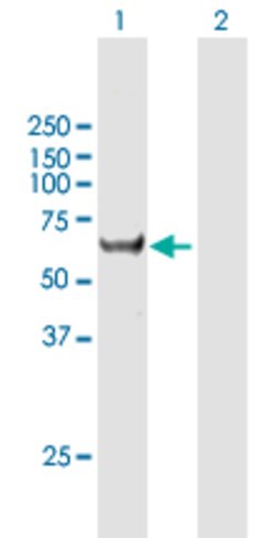 CCT8L2, Rabbit anti-Human, Polyclonal Antibody, Abnova 100&mu;L; Unconjugated:Antibodies,