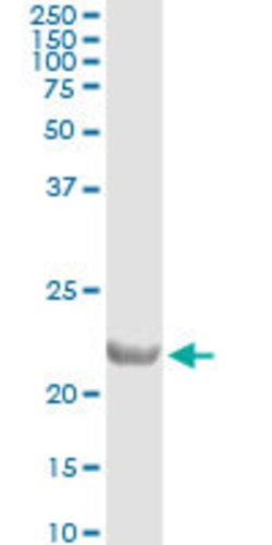 COMMD1, Mouse anti-Human, Clone: 2A12, Abnova 100&mu;g; Unconjugated:Antibodies,